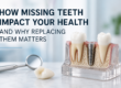 How Missing Teeth Can Affect Your Overall Health More Than You Think