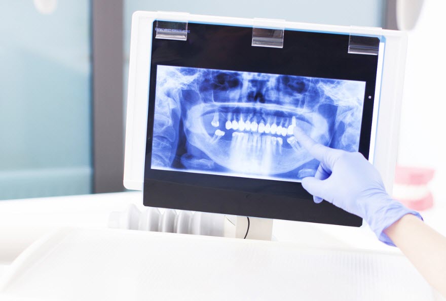 digital x ray downingtown pa
